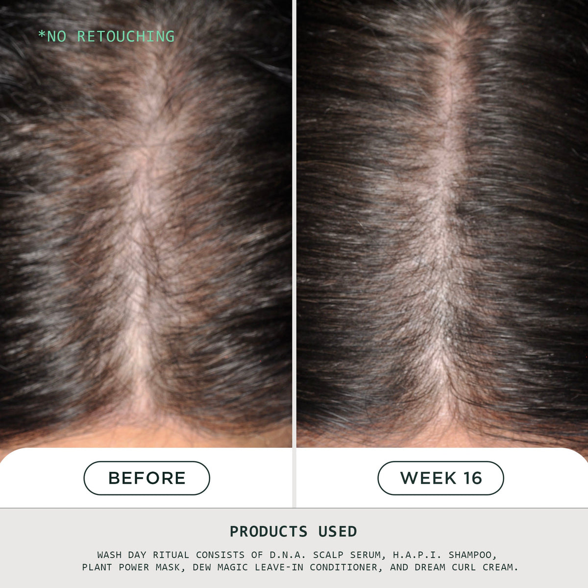 D.N.A. Scalp Serum