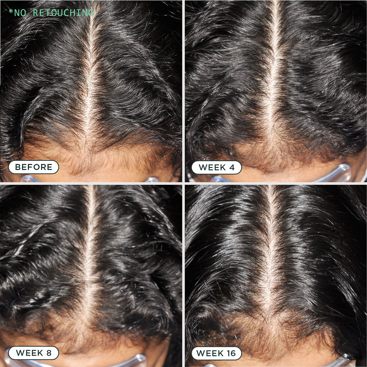 D.N.A. Scalp Serum