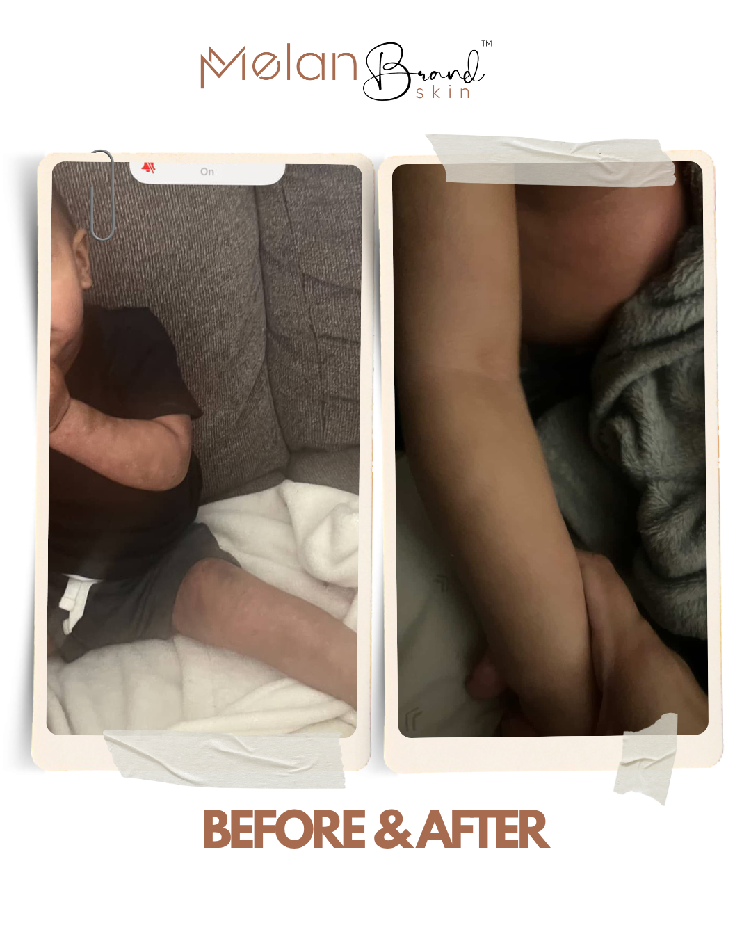 MelanMoisture Extreme Cream