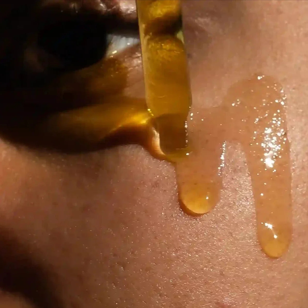 Facial Moisturizer (Ingrown Hair/Acne)
