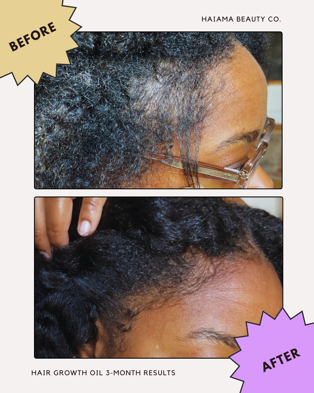 Grow & Strengthen Elixir | Organic Hair Growth Oil