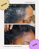 Grow & Strengthen Elixir | Organic Hair Growth Oil
