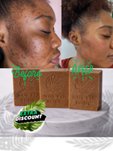 Turmeric + Vitamin C Even skin tone Bar Soap — 3 thick Bars