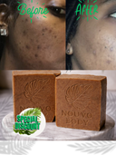 Turmeric + Vitamin C Even skin tone Bar Soap — 2 thick Bars