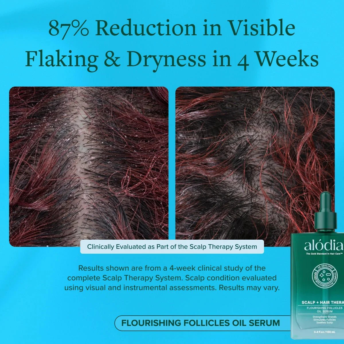 Flourishing Follicles Oil Serum