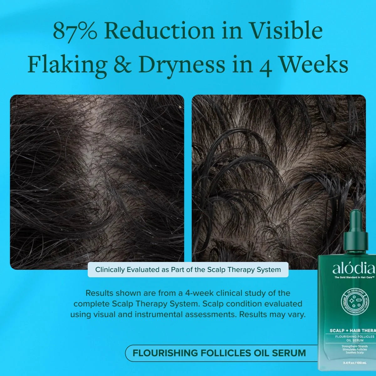 Flourishing Follicles Oil Serum