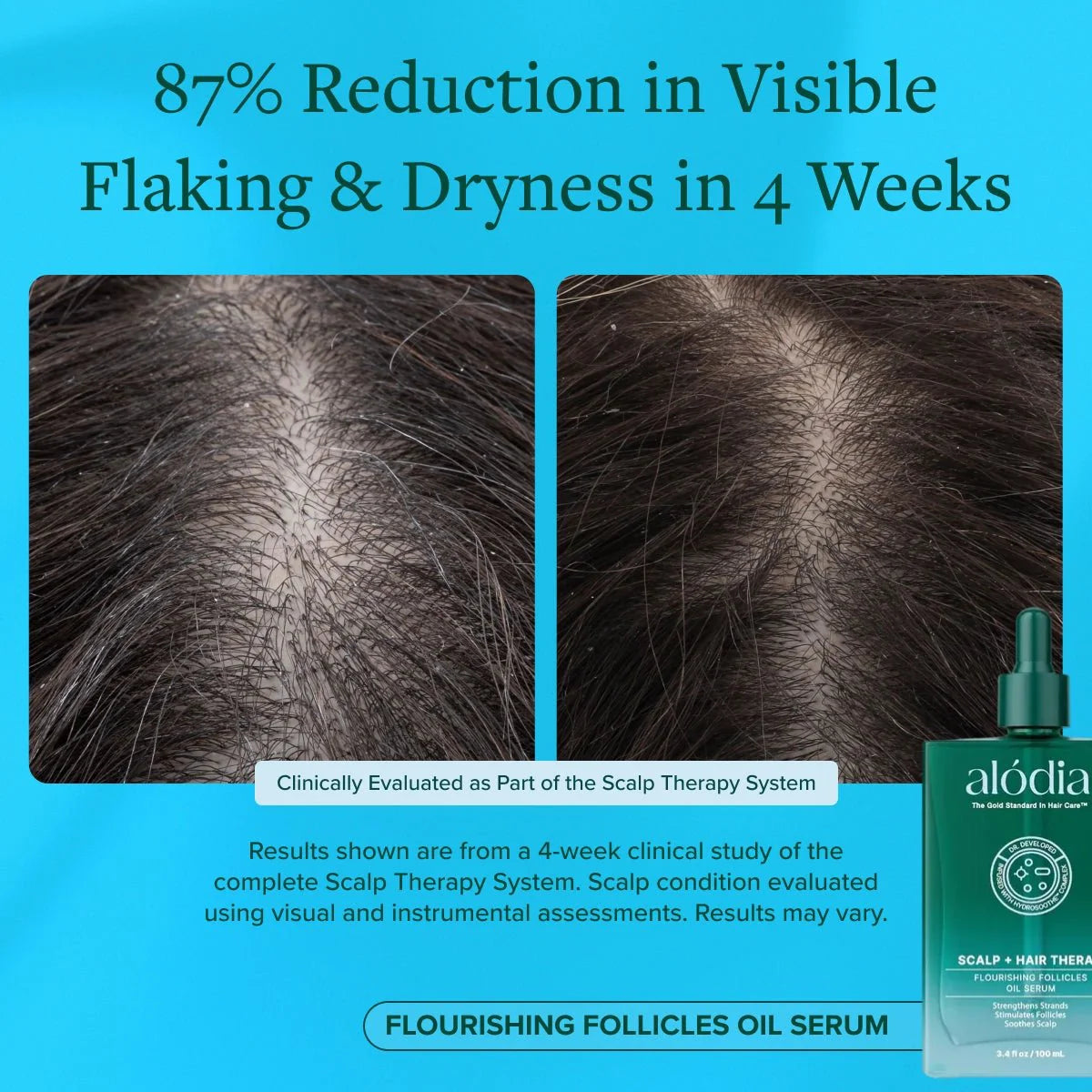 Flourishing Follicles Oil Serum