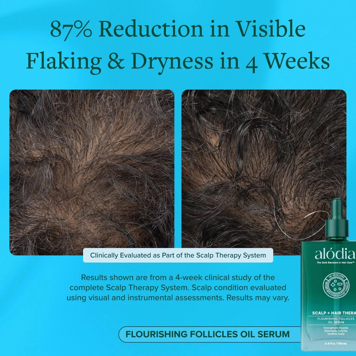 Flourishing Follicles Oil Serum