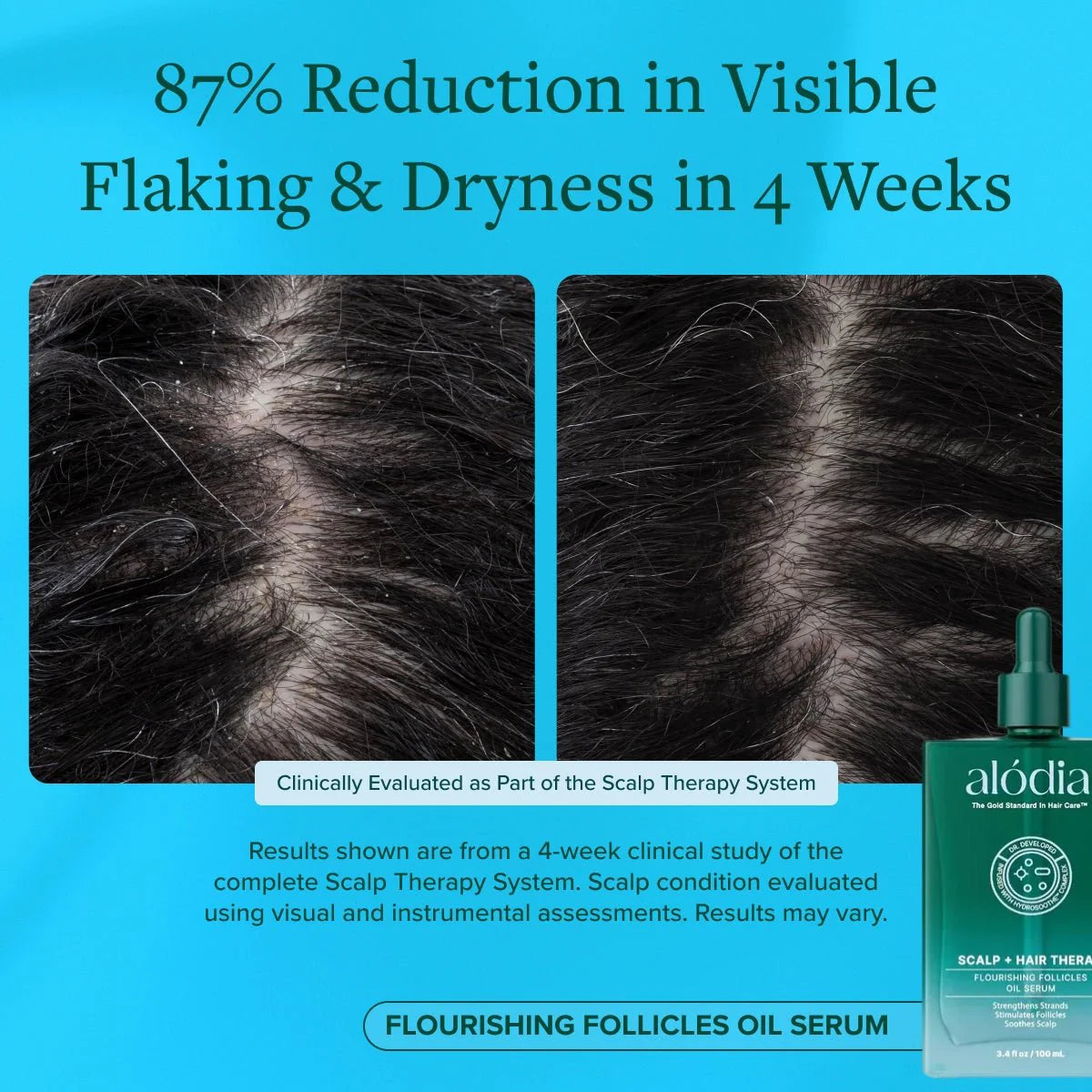 Flourishing Follicles Oil Serum