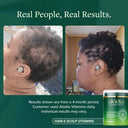 Hair & Scalp Vitamins