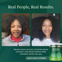 Hair & Scalp Vitamins