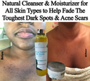 KoJic & Turmeric Even skin tone  — Extra strength Brighten kit