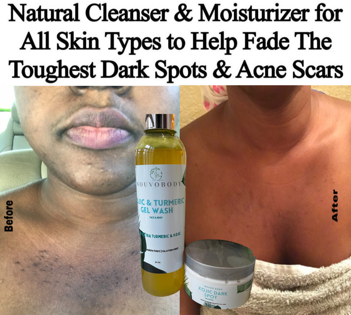 KoJic & Turmeric Even skin tone  — Extra strength Brighten kit