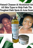 KoJic & Turmeric Even skin tone  — Extra strength Brighten kit
