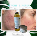 KoJic & Turmeric Even skin tone  — Extra strength Brighten kit