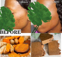 Turmeric + Vitamin C Even skin tone Bar Soap — 3 thick Bars