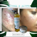 KoJic & Turmeric Even skin tone  — Extra strength Brighten kit