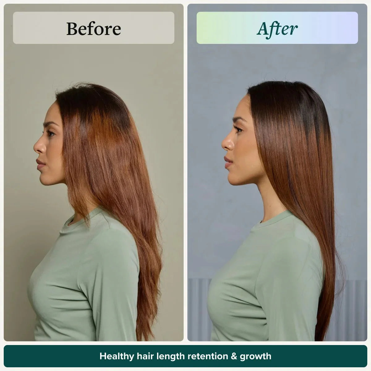 Length Retention System
