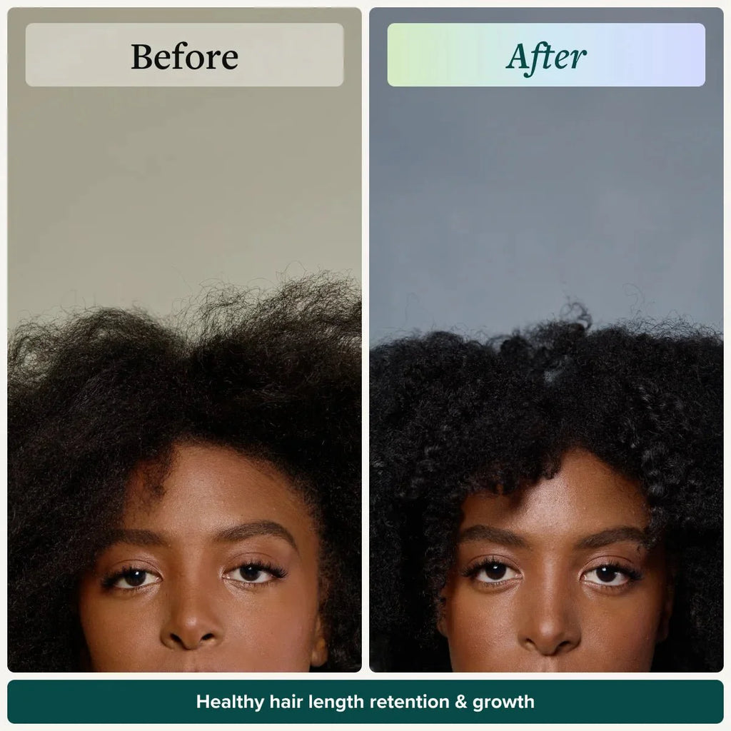 Length Retention System