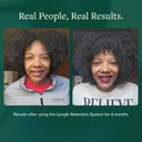 Length Retention System