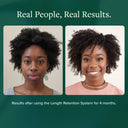 Length Retention System