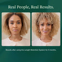Length Retention System