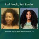 Length Retention System