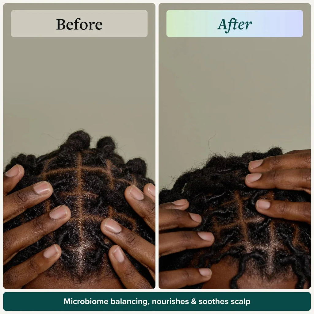 Scalp Therapy System