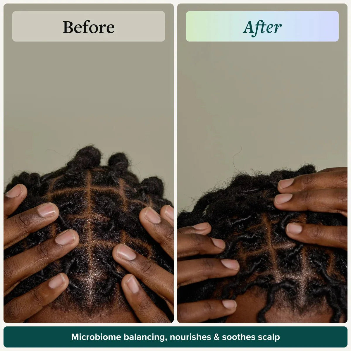 Scalp Therapy System