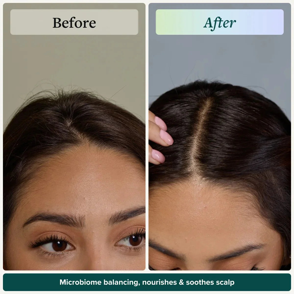 Scalp Therapy System