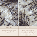 Seborrheic Itchy Scalp Solution | Herbal Probiotic Leave-in